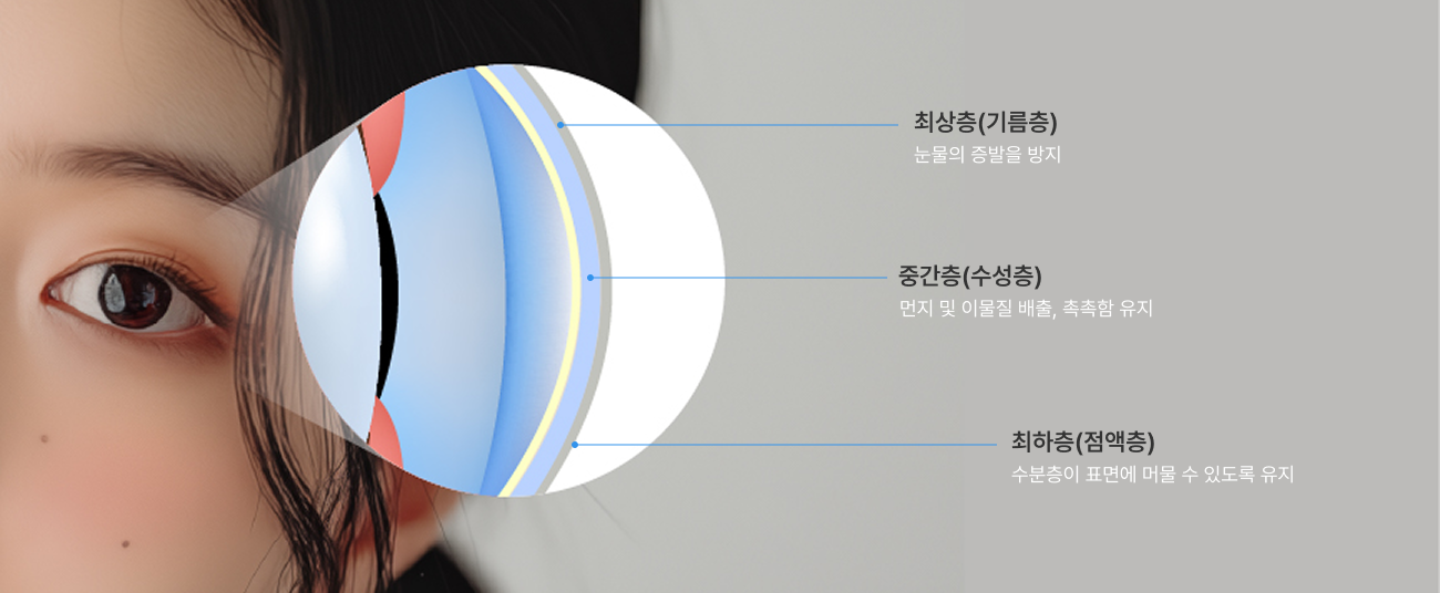 안구건조증 원인