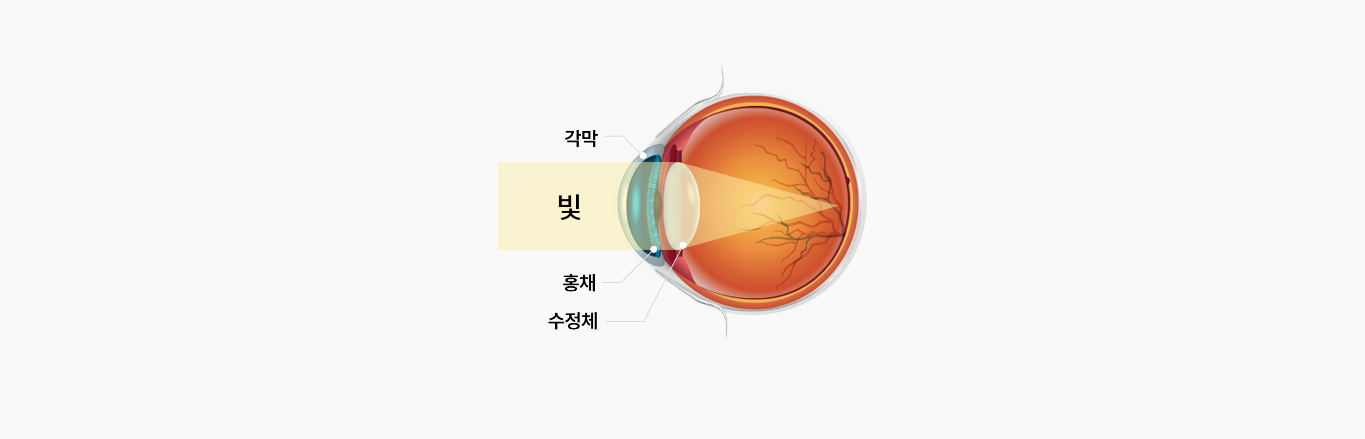 노안