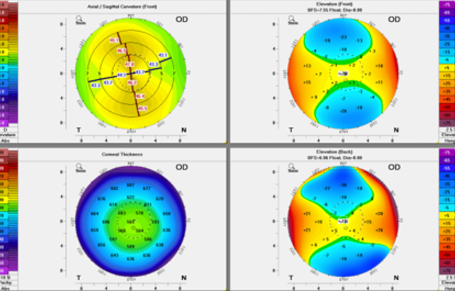 Cornea shape basic analysis