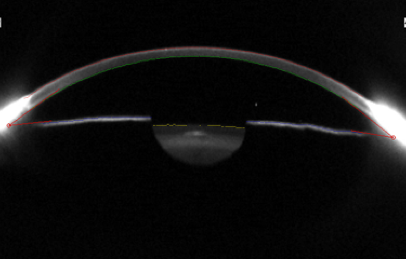 Cornea shape basic analysis