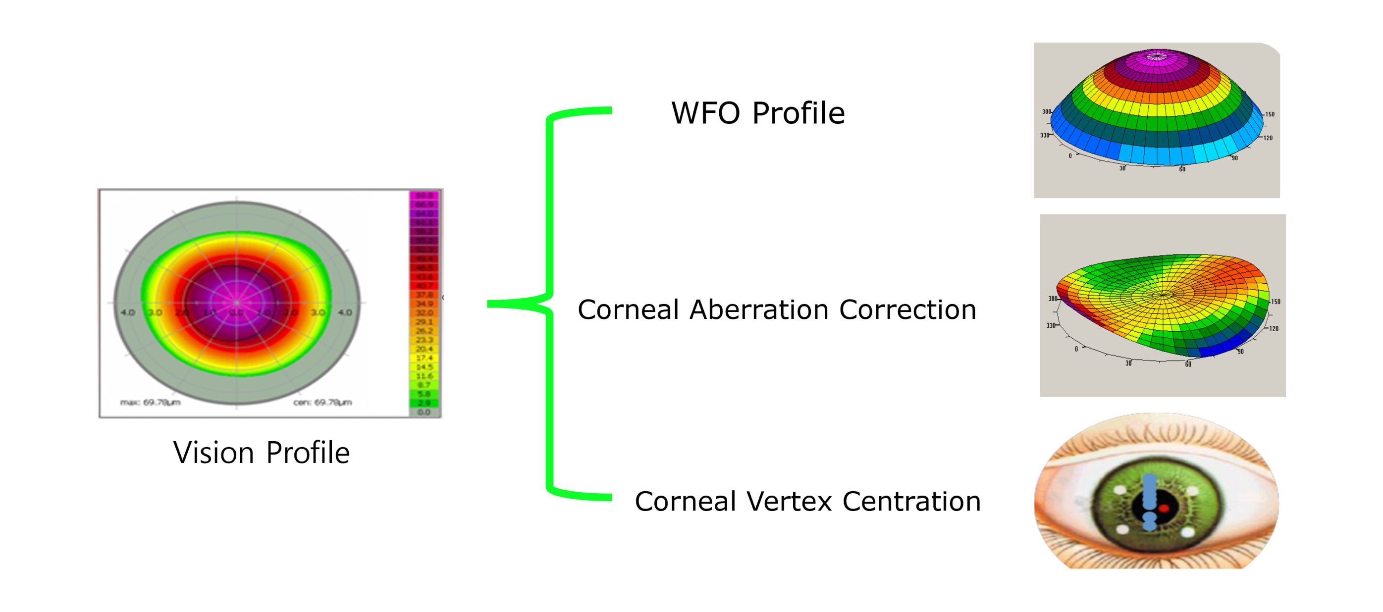 Customized vision correction concept