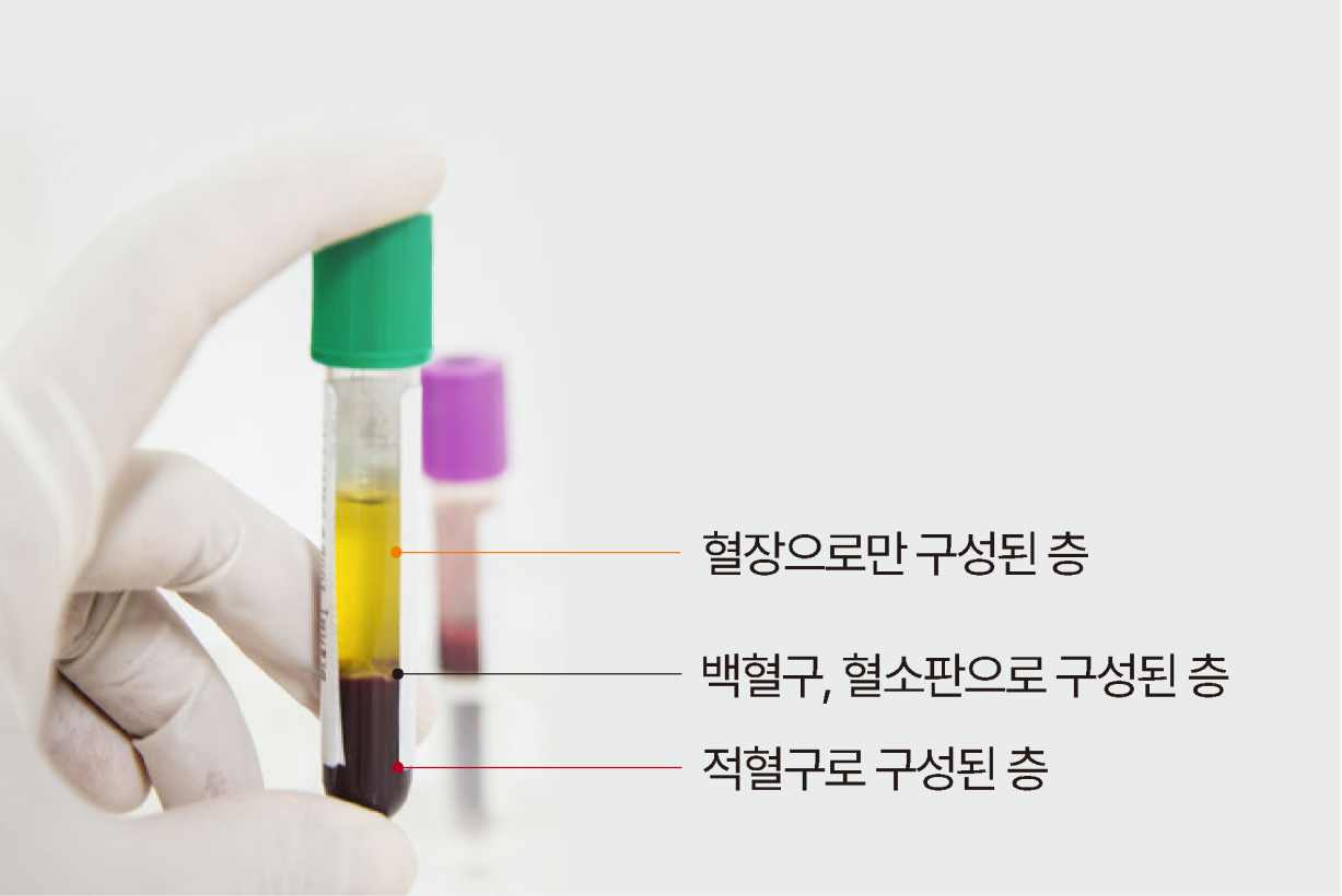 자가혈청