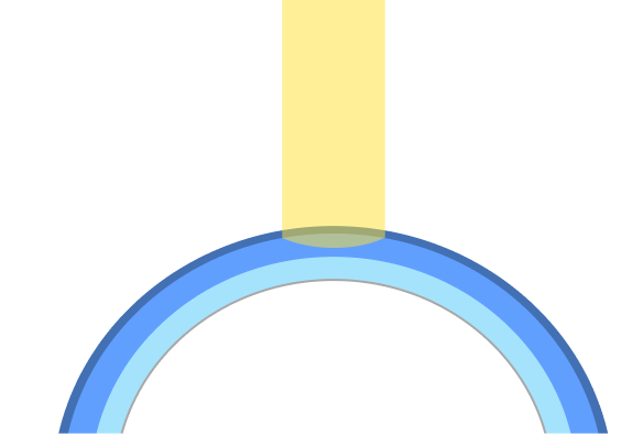 라섹